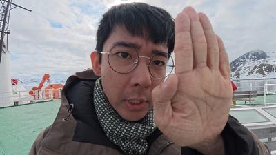 阿滴深掌紋被讚好命!醫揭殘酷真相 眼下一特徵也中