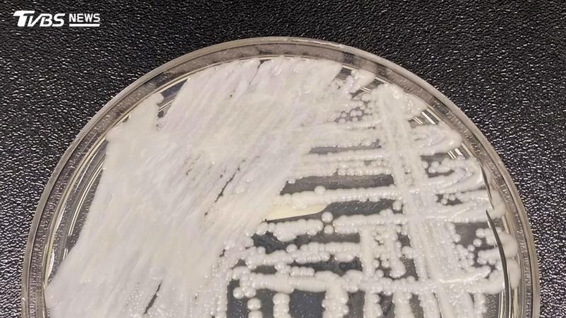 死亡率高達60%!超級真菌「耳念珠菌」侵襲美國23州