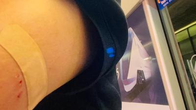 遇同機乘客搶快下機狂衝擠!婦科名醫慘被撞掛彩 長榮回應了
