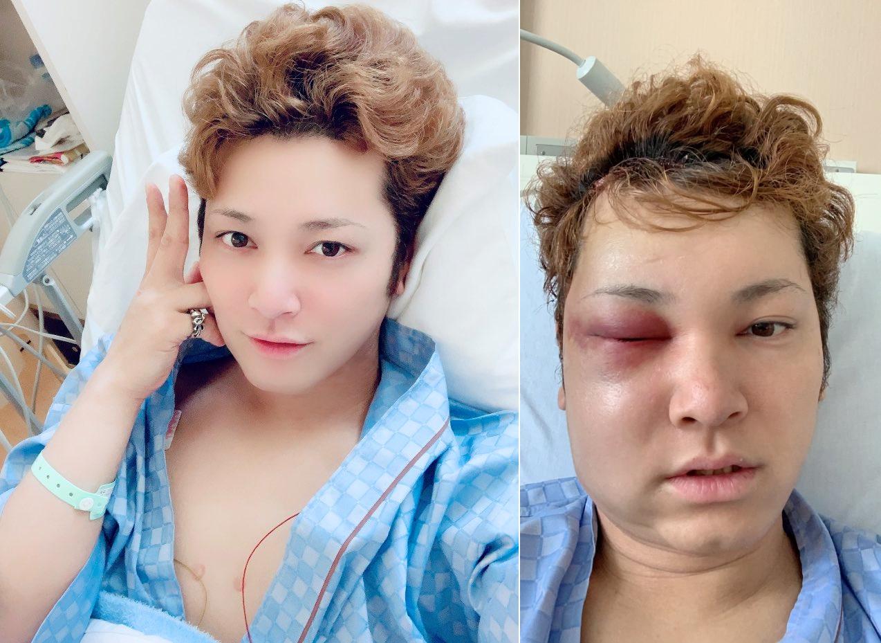 間瀨翔太病發後就一直保持樂觀態度。（圖／翻攝自間瀨翔太推特）