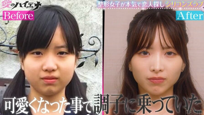 國一就動刀!24歲日本前女偶像砸110萬整形 對比照曝光