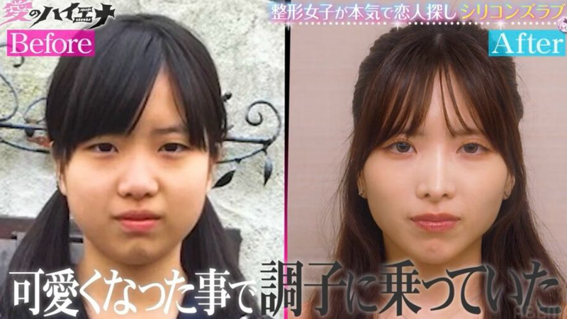 日本前偶像MIYU分享整形前後的照片。(圖/翻攝自ENTAME NEXT)