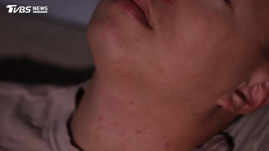 每週失眠3次、持續3個月要注意!醫揭「這疾病」引起全身危機(圖/TVBS)