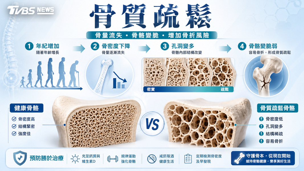 跌一跤就骨折不是運氣差!醫揭出現「這疾病」... 像「骨牌效應」恐一路失能(圖/TVBS)