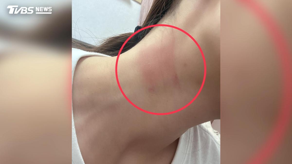 獨/控「前男友約還錢竟亮刀」 女嚇壞衝派出所還被堵