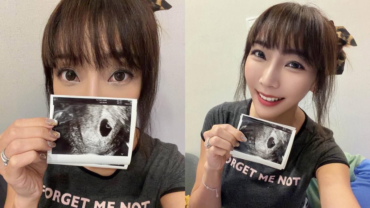 42歲第一次自然受孕!女星喜曬超音波照