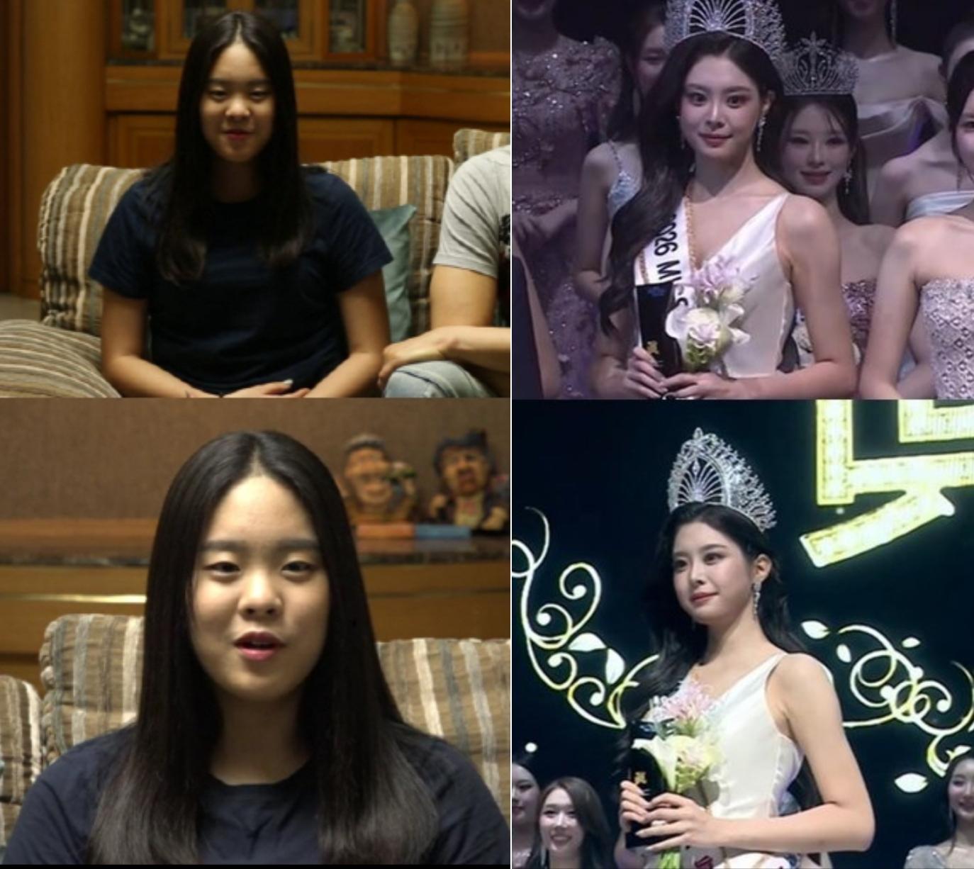 禹瑞允的「Before & After」照片引發爭議。(圖/翻攝自nate pann)