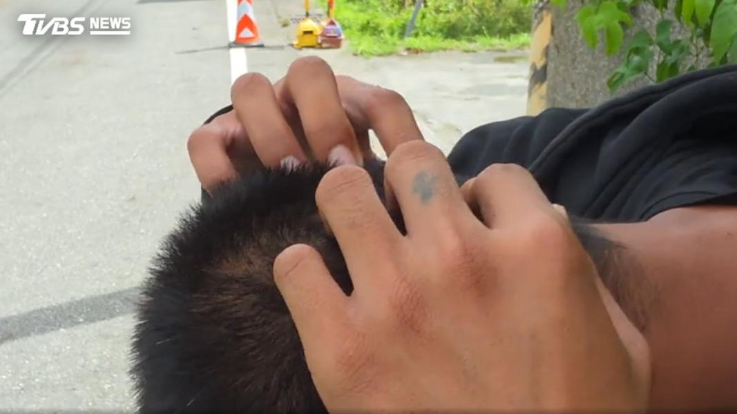 遭毆周姓男子無奈指出頭部傷口,這次事件帶給他不小陰影。(圖/TVBS)