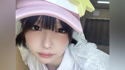 「惡魔偶像」ano自爆嚴重車禍!臉部兩處骨折狂流血 隔天竟照常開工