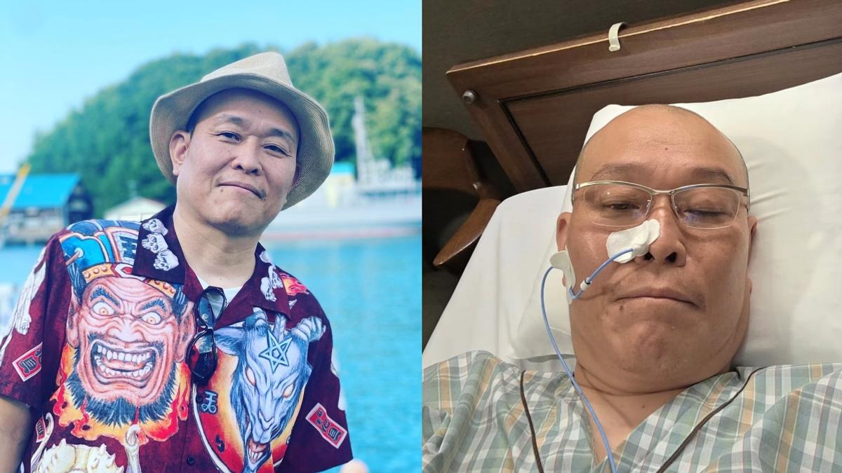資深男星出事!「肝膿瘍破裂」送醫開刀