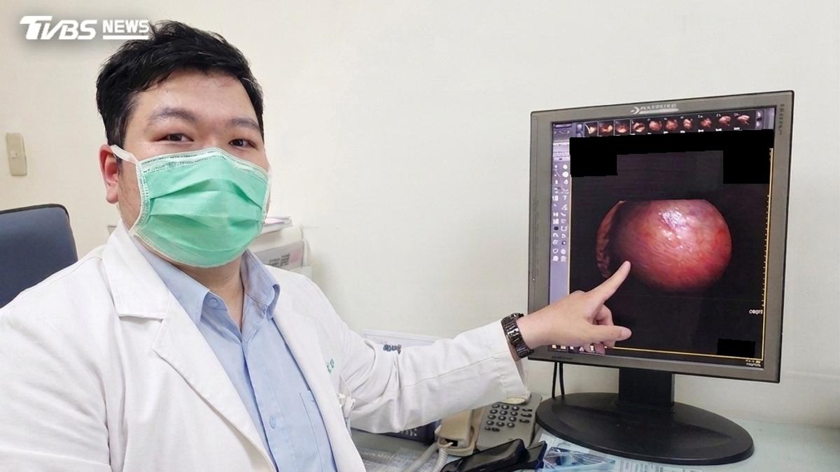 子宮肌瘤4年暴增17cm!45歲女便祕腹脹 肚子像小玉西瓜