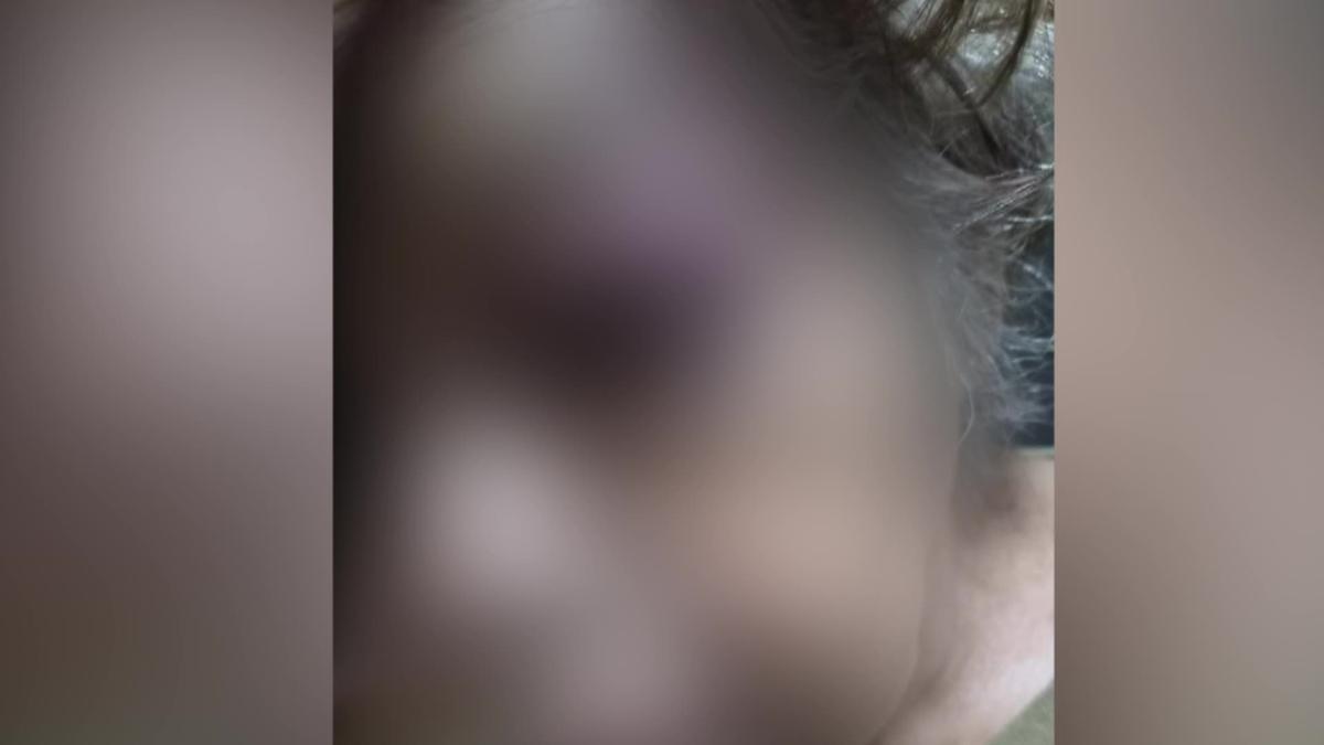外籍看護虐打93歲嬤!拉髮甩頭、拳腳狂踹 家屬怒報警揭惡行