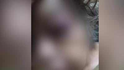 外籍看護虐打93歲嬤!拉髮甩頭、拳腳狂踹 家屬怒報警揭惡行