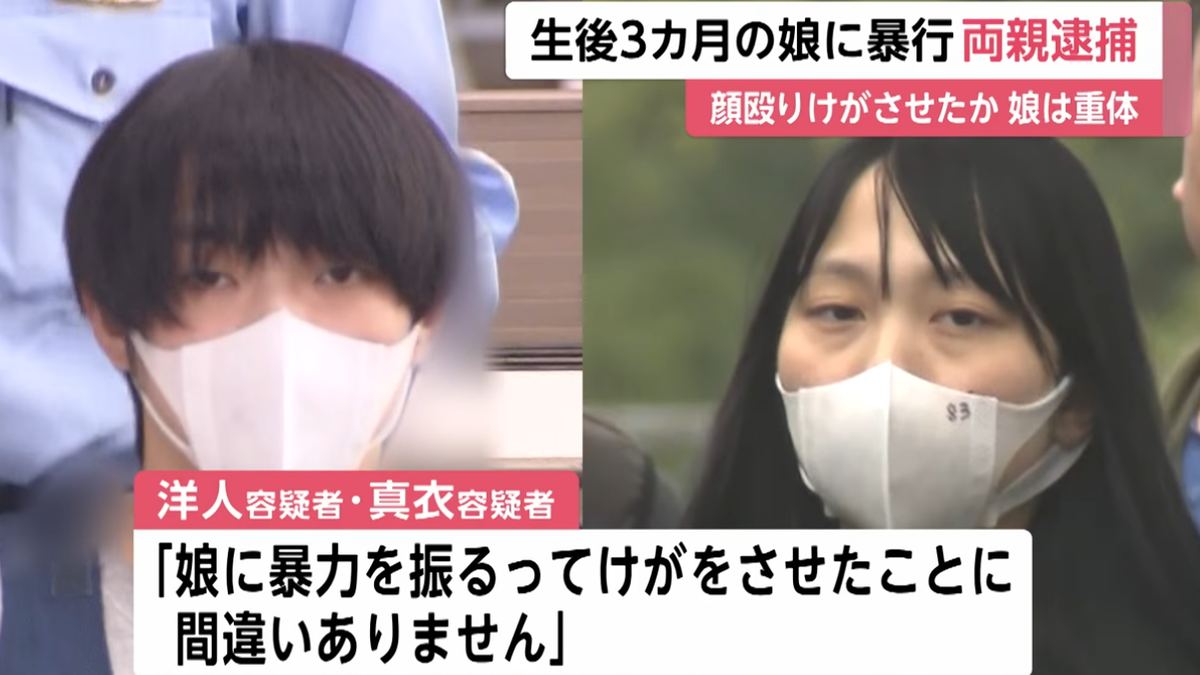 日本狠父母虐女兒!多次掌摑臉部又搖晃 3月大女嬰顱內出血命危
