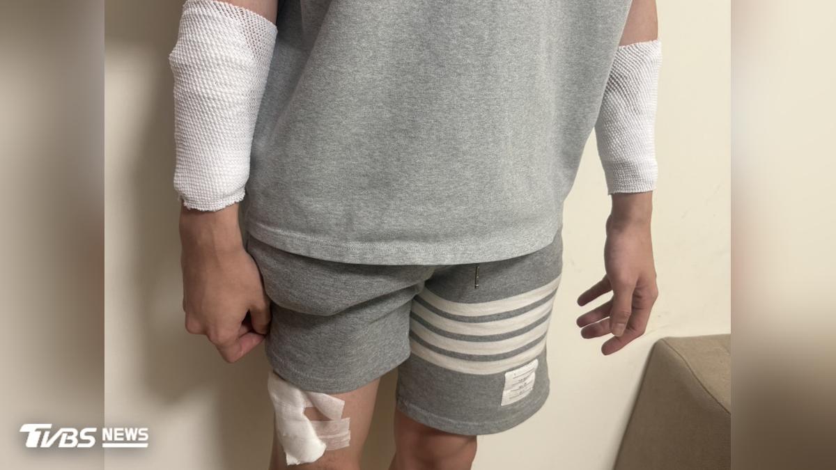 快訊/疑病患家屬持刀襲擊!苗栗24歲男護理師手、腿慘遭劃傷
