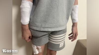 快訊/疑病患家屬持刀襲擊!苗栗24歲男護理師手、腿慘遭劃傷