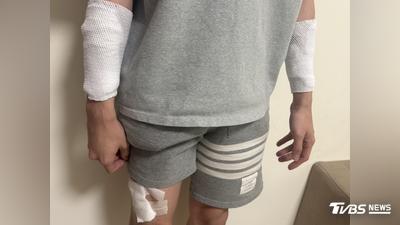 大逆轉!苗栗男護理師被砍是自導自演 「想討拍」原因曝