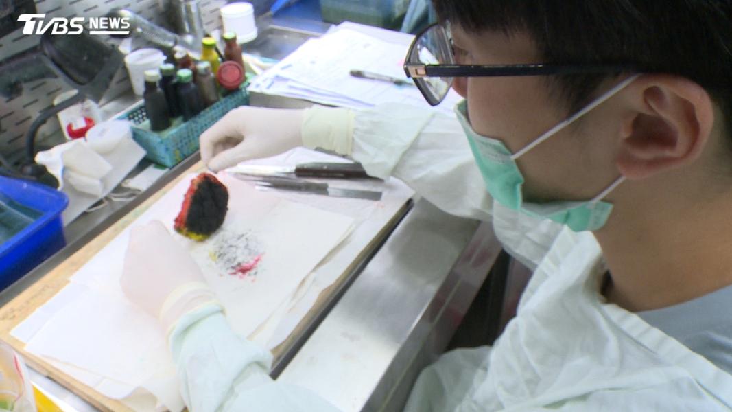 不直接看診卻是幕後判官!揭密病理醫師 如何判讀腫瘤、揪出癌細胞!(圖/TVBS)