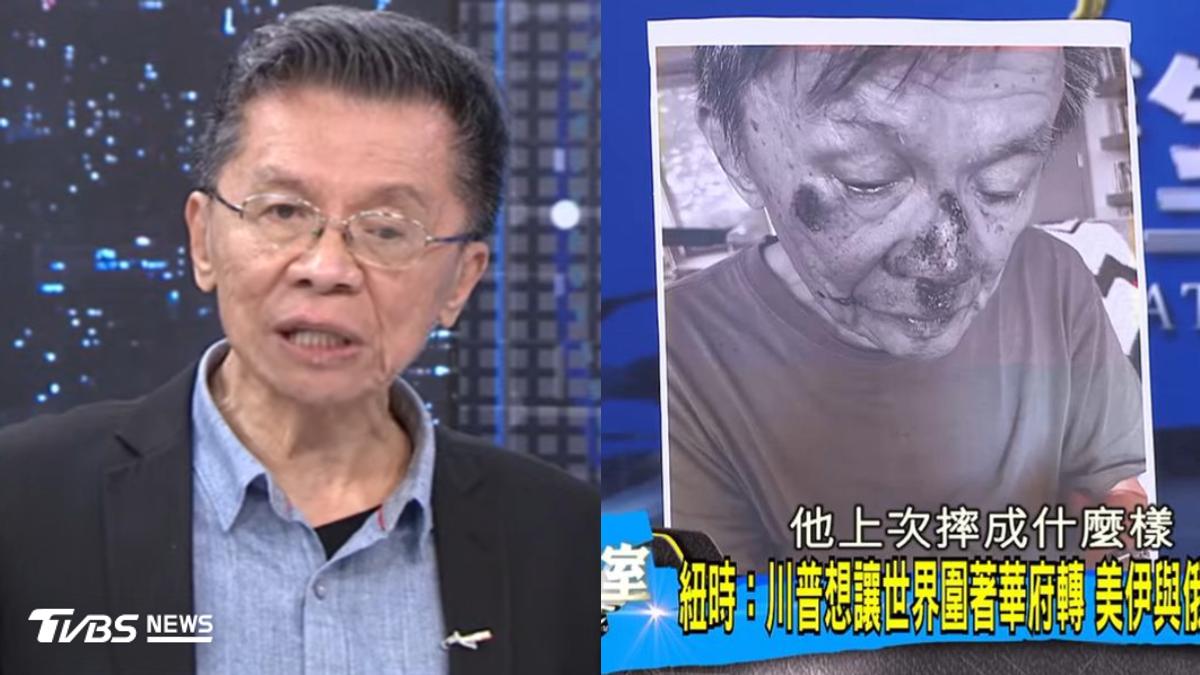 沈富雄臉著地重摔!離奇跌法「遭疑換腎」 本人回應了