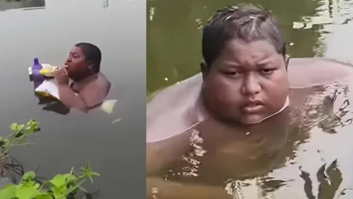 全身像火燒!印度少年患怪病長年泡池塘 獲富豪出資醫治揭病因