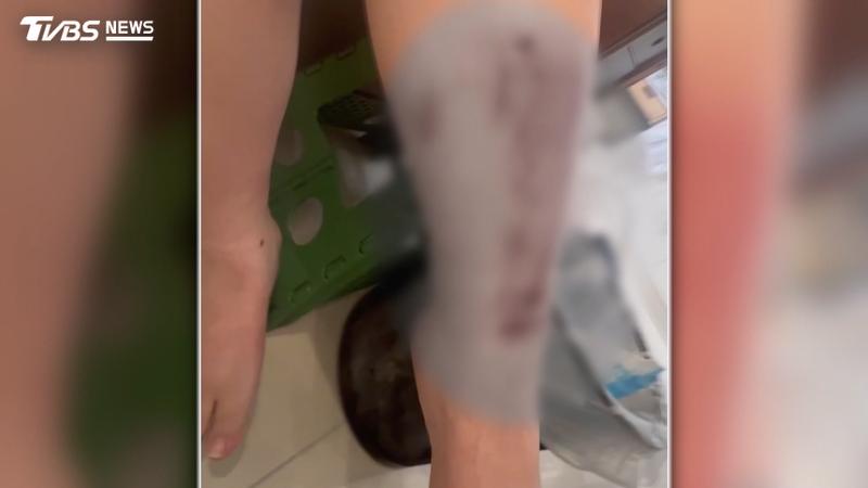 水溝蓋破洞成隱形殺手!她一腳踩空「滿腿是血」路人嚇壞(圖/TVBS)