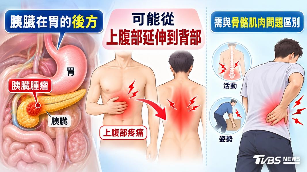 胰臟癌第三期原無法開刀!化療結合重粒子縮小腫瘤 再手術切除...重獲新生!(圖/TVBS)