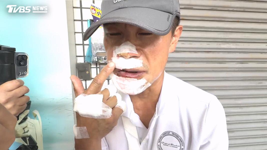 騎公路車遇「奪命塑膠袋」!8年老手摔車 門牙斷.骨裂.唇縫8針(圖/TVBS)