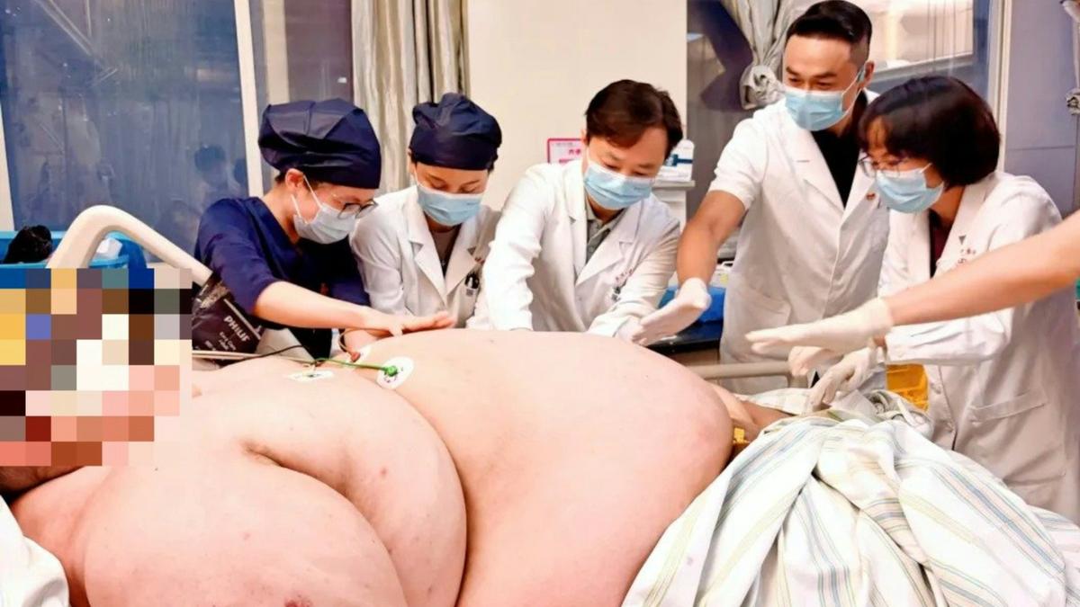 再胖人就沒了!317KG「陸第2胖」命危 12醫護抬床搶救