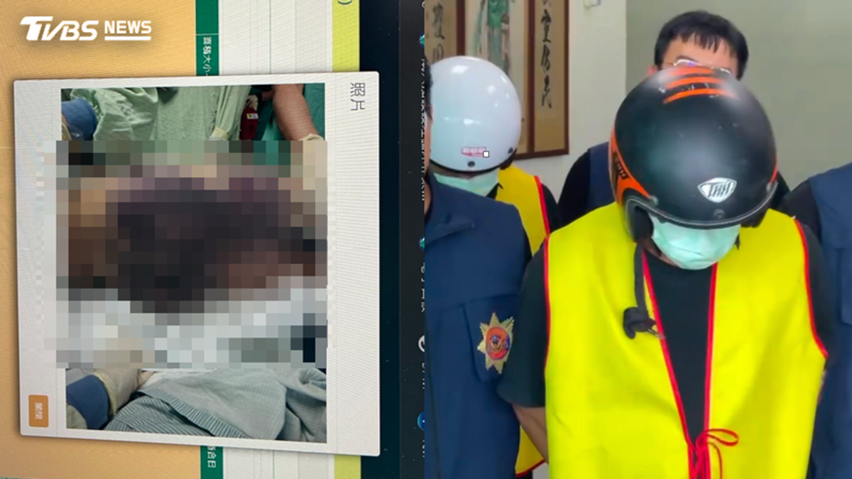 上兵遭鄰居哥球棒狂抽「雙臀發黑」亡 解剖結果揭慘烈傷勢