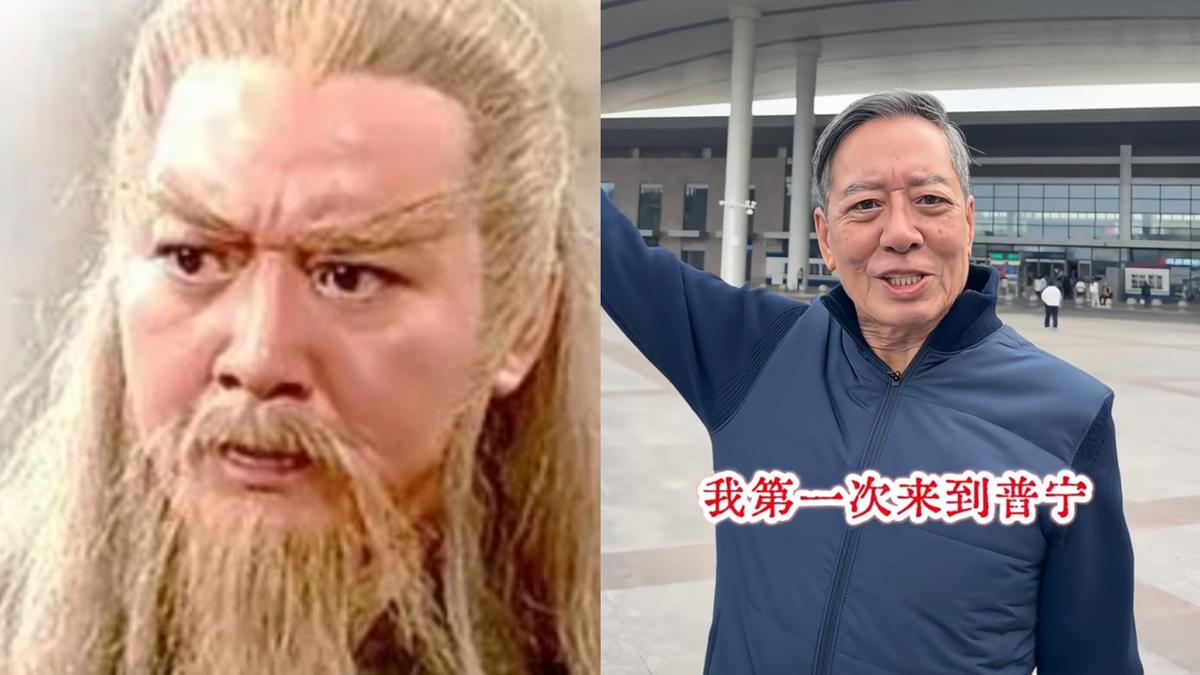 《射鵰》黃藥師昔住院40天爆瘦!醫揭腎結石警訊:恐致命