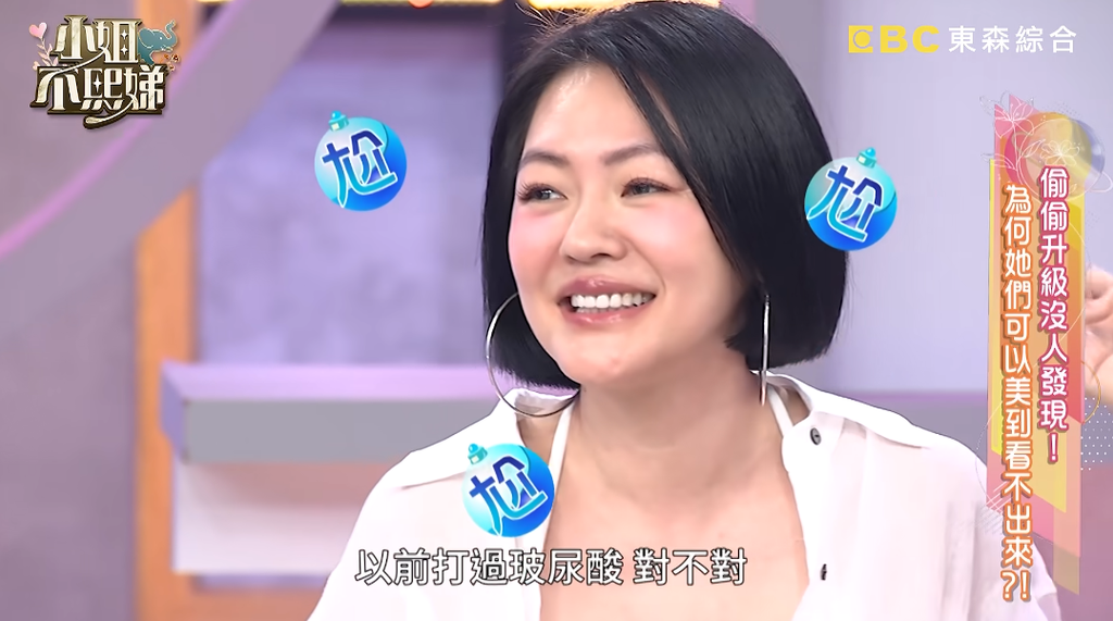 小S-小姐不熙娣-小S醫美-小S打玻尿酸-林睿禹醫師-小S微整型-小S偷做醫美-玻尿酸-醫美鑑定-蘋果肌