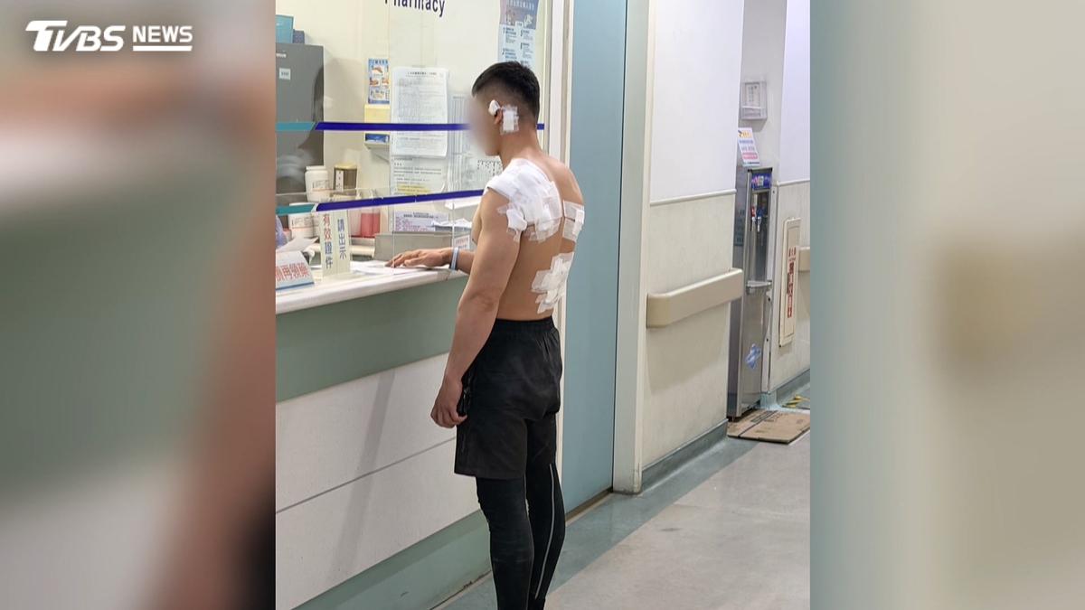 薪資+口角糾紛!台中工人遭10餘人「圍毆拖行」眼睛瘀青