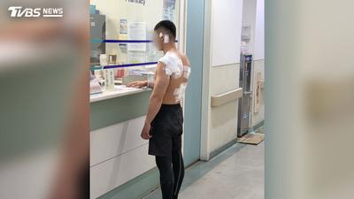 薪資+口角糾紛!台中工人遭10餘人「圍毆拖行」眼睛瘀青