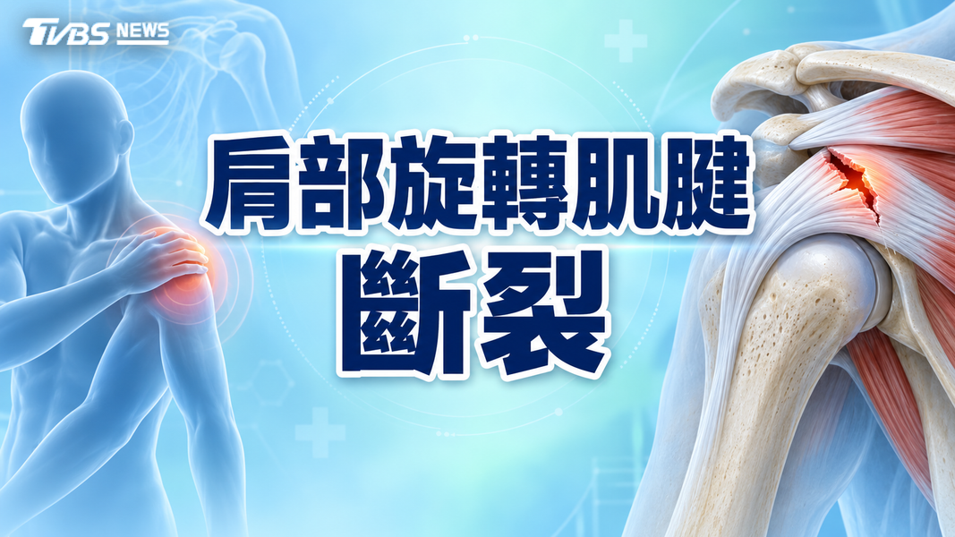 肩膀夜間痛、手舉不高恐旋轉肌腱撕裂!醫揭治療與手術時機(圖/TVBS)