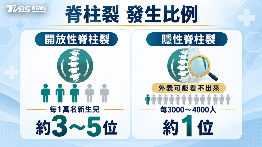 孩子脊椎側彎恐是「這重大疾病」!醫師示警:走路不穩、排尿異常是警訊(圖/TVBS)