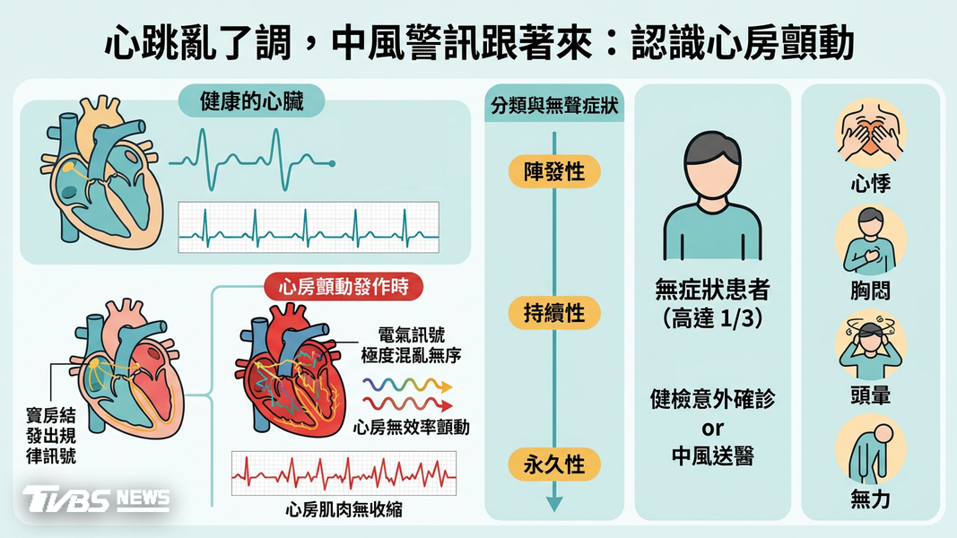 心房顫動恐增中風5倍! AI精準診斷搭配新式電燒治療一次看(圖/TVBS)