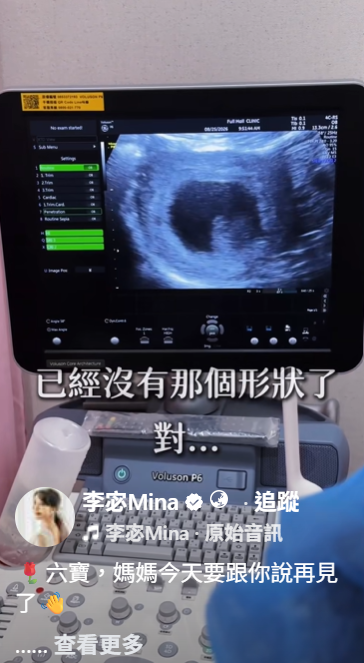 李宓透露，此次超音波已照不到寶寶的形狀。（圖／翻攝自李宓臉書）