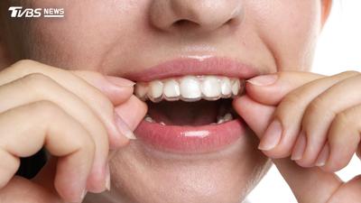 戴牙套能喝可樂、黑咖啡?代價曝光 牙醫授3招解套