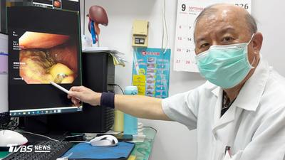 以為只是嘴破!老翁忍痛1個月 竟查出7公分癌腫瘤已蝕骨