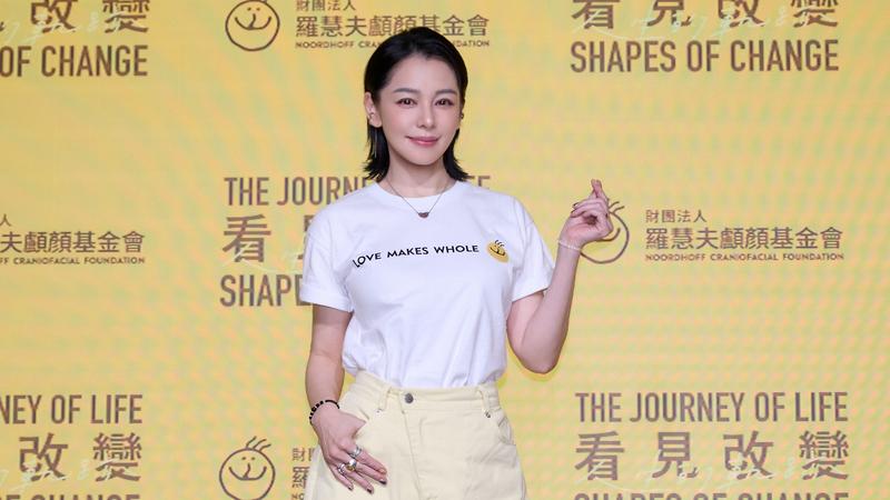 徐若瑄首揭疤痕。(圖/羅慧夫顱顏基金會《看見改變》攝影展覽提供)