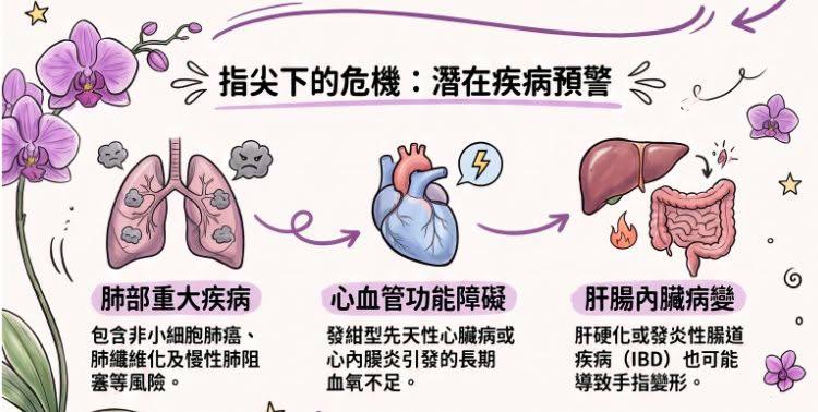 有杵狀指的民眾，身體可能投射三大健康危機。（圖／振興醫院FB）