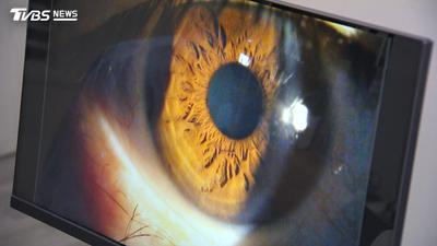 眼睛劇痛又想吐?隅角閉鎖型青光眼急性發作警訊一次看