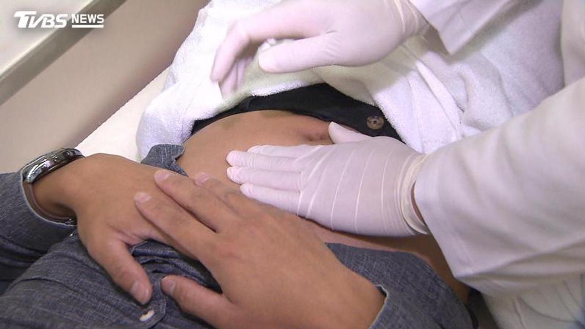 25歲工程師沒血便、腹瀉竟得大腸癌二期