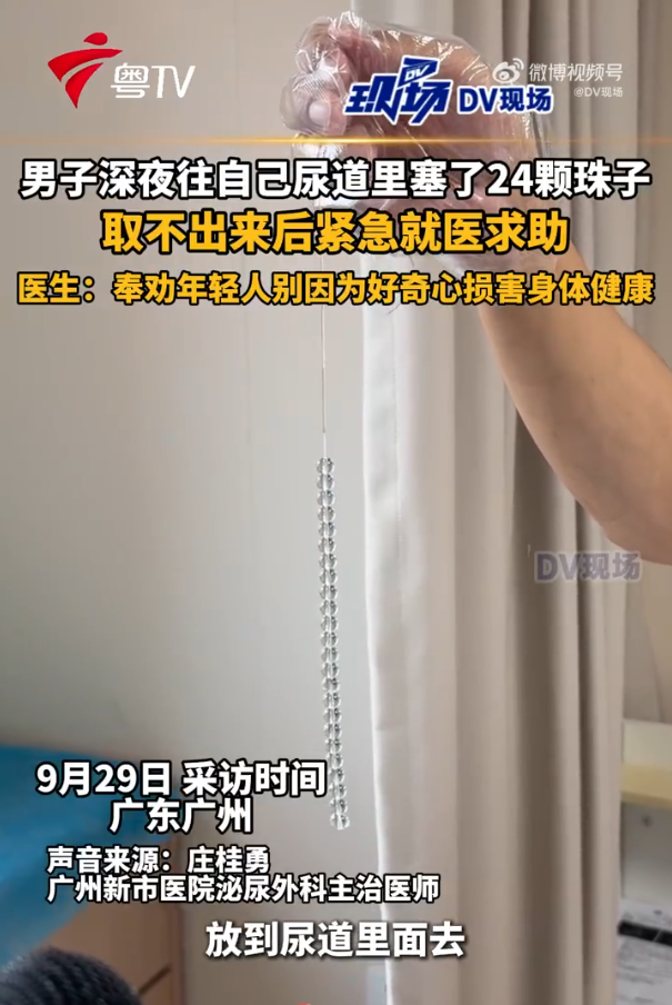 陸男將珠鍊塞進尿道，所幸手術後有順利取出。（圖／翻攝自DV現場）