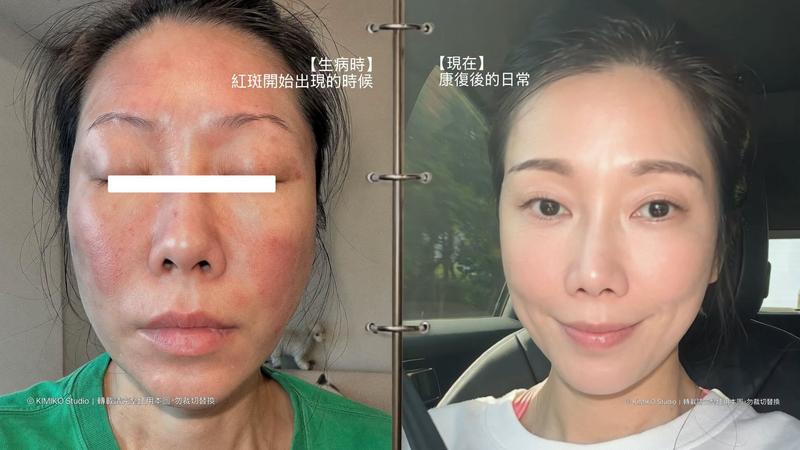 KIMIKO-KIMIKO老公-KIMIKO老師-KIMIKO近況-KIMIKO過敏