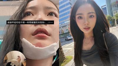 啦啦隊女神怡琪摔車破相!最新傷勢曝光 急宣布:工作暫停一週