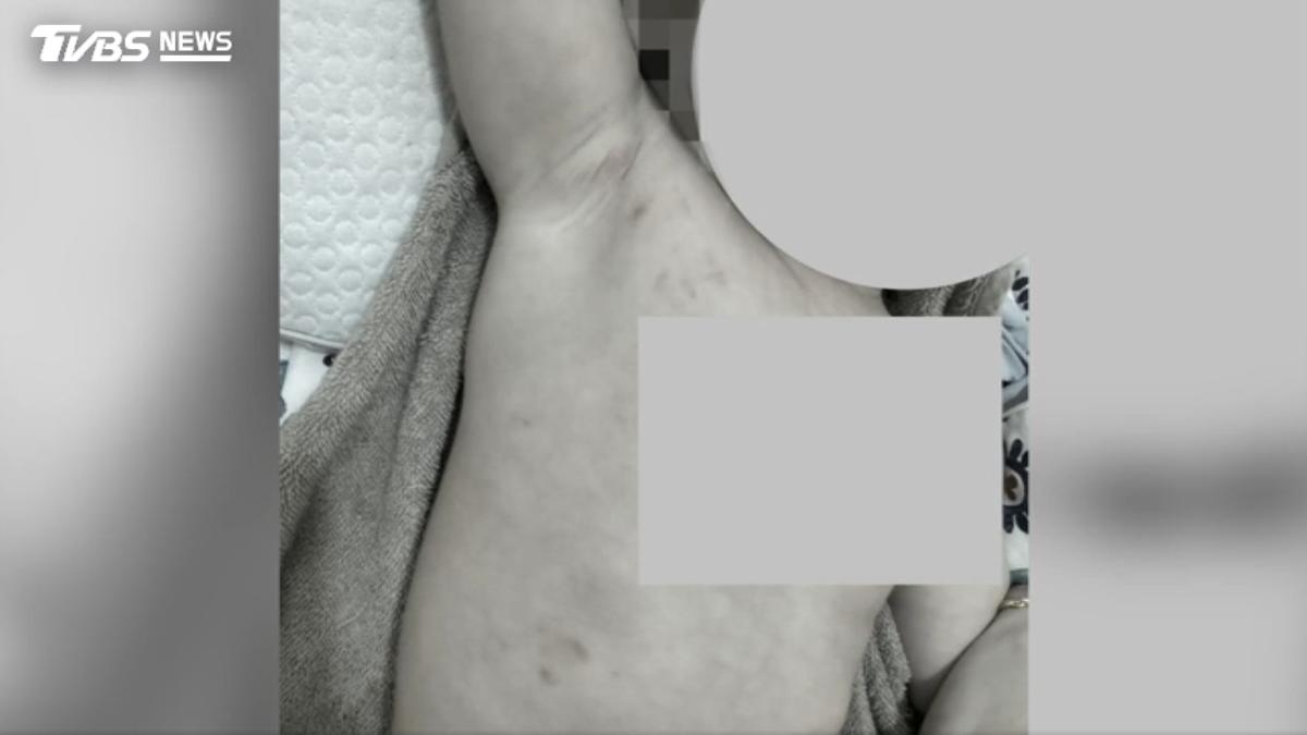 控送托嬰滿身傷 母哽咽:沒察覺到女兒訊號