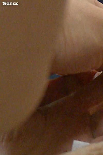 糖尿病男女大不同!女性留意焦慮憂鬱、男性心腎疾病較早出現