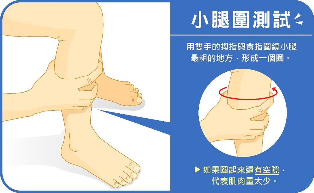 小腿圍如果最粗的地方比雙手圍起的圈還小，這表示肌肉量不足。（圖／聯合醫院提供）
