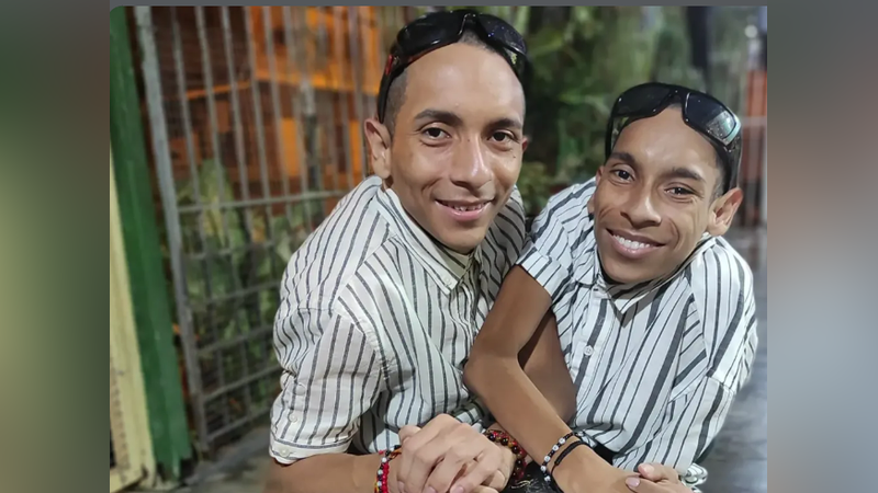 厄瓜多全國唯一的連體嬰兄弟27歲的何塞·路易斯(José Luis)與何塞·阿爾曼多(José Armando Cevallos)不幸離世。(圖/翻攝自IG@siamesesdelecuador)
